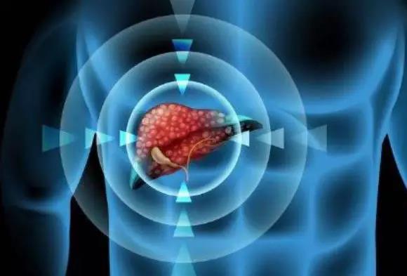 【揭秘】不抽烟、不喝酒、没遗传，为什么得恶性肿瘤的....(图5)