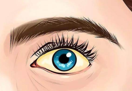 超过60%的患者把胰腺癌当成胃炎，腰背若有一个表现...(图4)