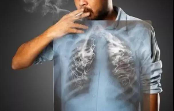 【提醒】为什么年轻人患肿瘤率越来越高?这6个原因必须关注(图2)