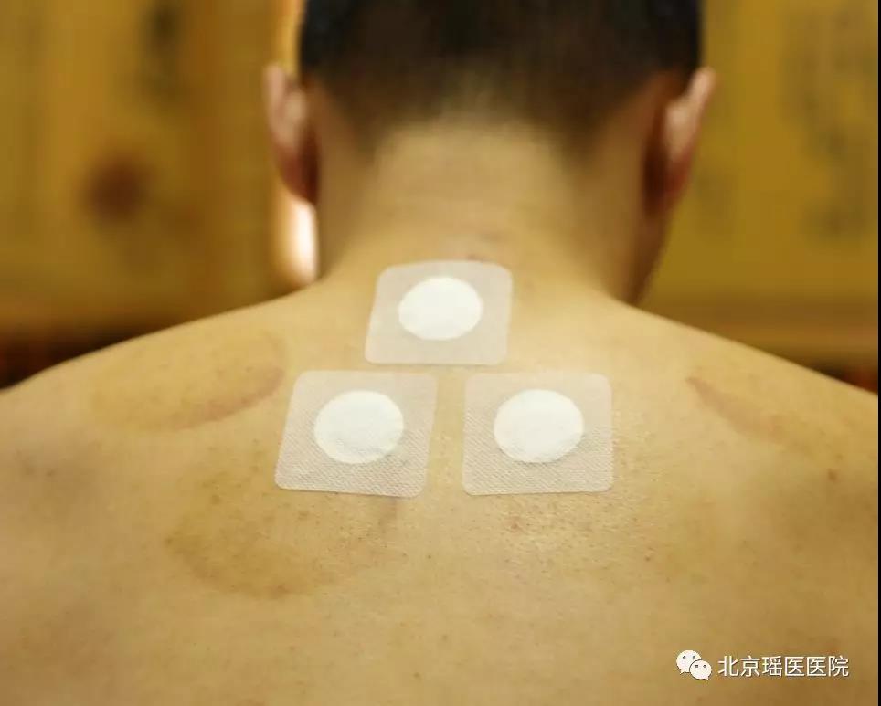 【健康】阳气足则百病消，夏季养阳正当时～(图3)