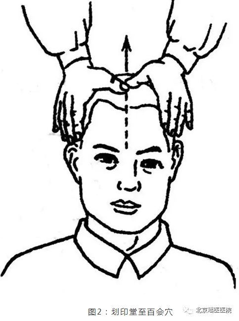 【实用】得了鼻炎怎么办?专家建议这么做!(图5)