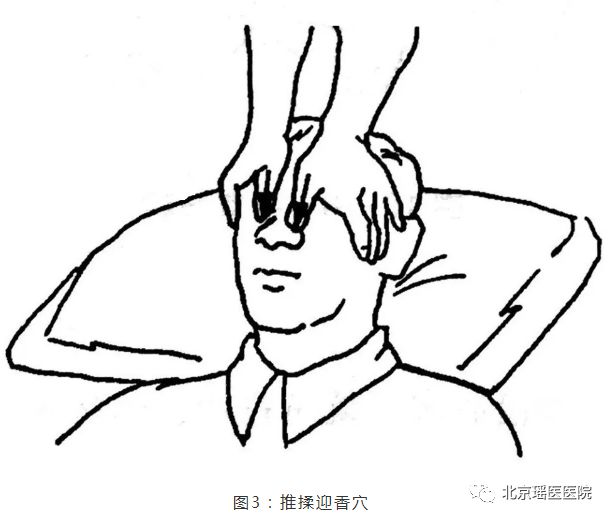 【实用】得了鼻炎怎么办?专家建议这么做!(图6)