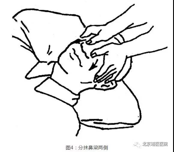 【实用】得了鼻炎怎么办?专家建议这么做!(图7)