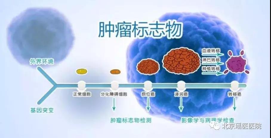 【科普】肿瘤标志物升高≠肿瘤，4种情况可以使其升高(图2)