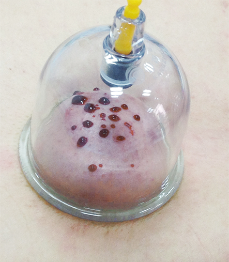 【福利】北京瑶医医院推出“年终康复月优惠健康.....(图3)