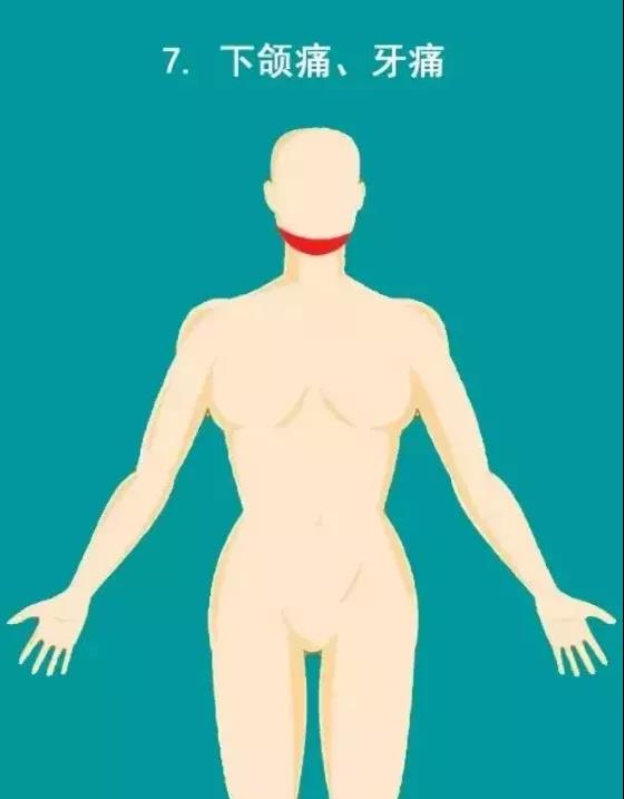 提醒 | 千万不要忽视心梗的10大疼痛部位!(图8)