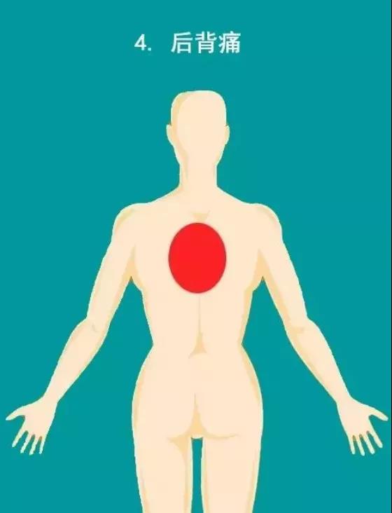 提醒 | 千万不要忽视心梗的10大疼痛部位!(图5)