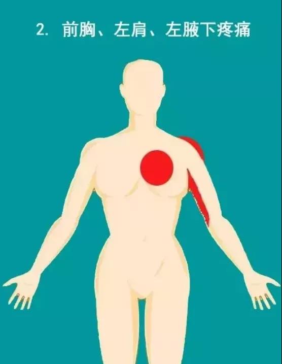 提醒 | 千万不要忽视心梗的10大疼痛部位!(图3)