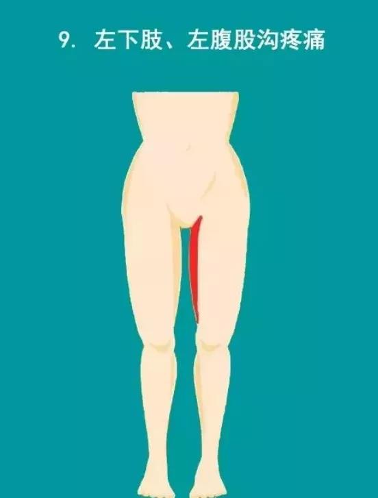 提醒 | 千万不要忽视心梗的10大疼痛部位!(图10)