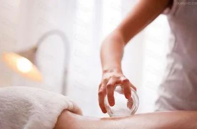 拔罐三问，拔罐前一定要知道的“一些真相”(图3)