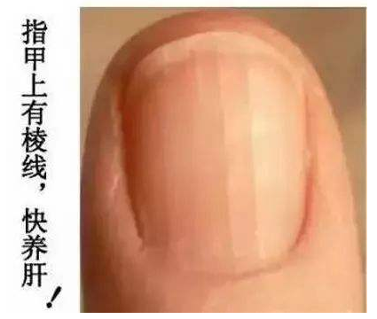 【健康】肝脏好不好，看看手有没有这四个症状?(图1)