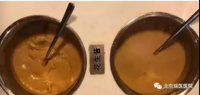 【震惊】世界最强致肿瘤物比氰化钾毒10倍，比砒霜毒68倍！(图5)