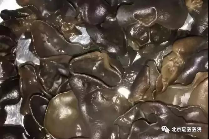 【震惊】世界最强致肿瘤物比氰化钾毒10倍，比砒霜毒68倍！(图3)