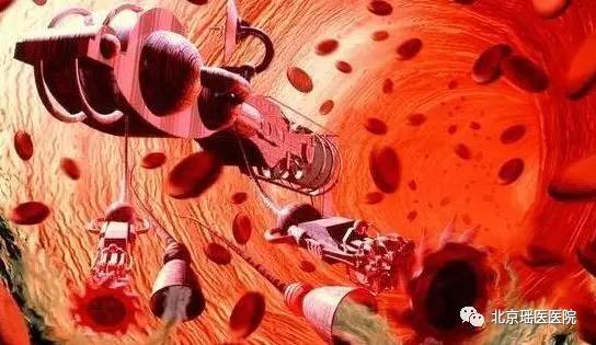 【健康】起床后有以下3种表现，说明你的血管已经开始堵塞(图1)