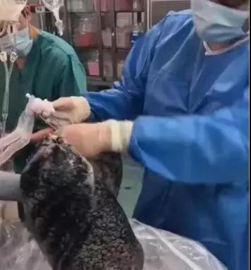 他抽烟30年，肺的照片刷爆朋友圈,看完你还抽烟吗?(图2)