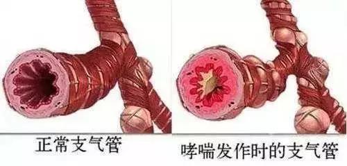 速效救心丸的最新用途! 99%的人不知道！(图3)