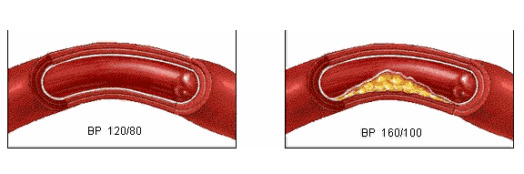 头皮发麻，可能是心脑血管疾病的信号!3个简单动作可预防(图4)