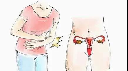 如何判断自己是否得了子宫腺肌症?(图2)