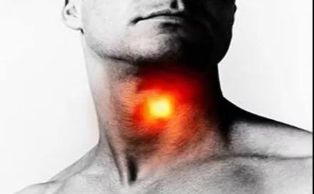 不得不知的咽喉癌早期症状，出现这六种异常，你就该....(图3)