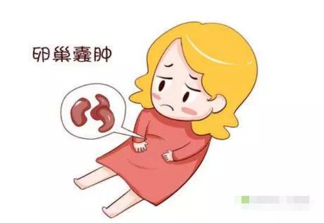 【警惕】女性黑眼圈，仅是变丑的节奏?当心卵巢囊肿才是真!(图2)