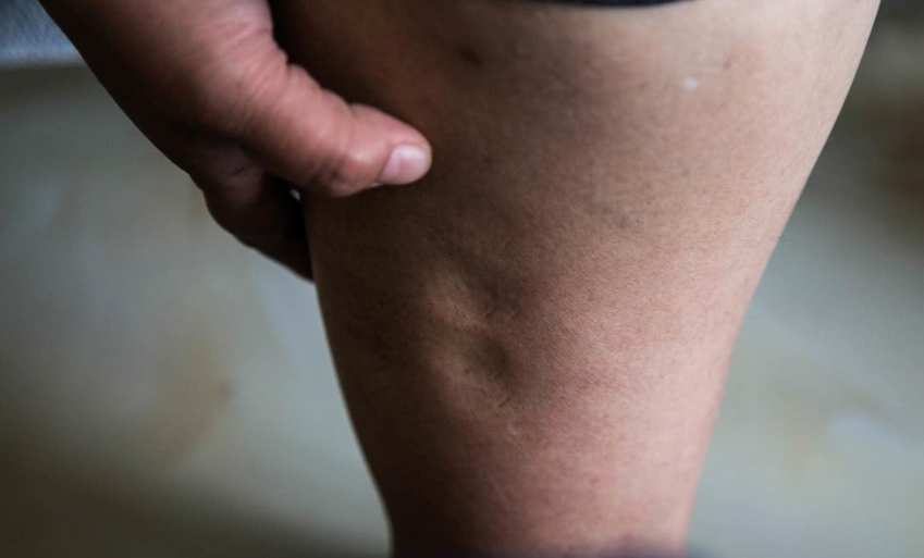 肾脏是身体的“劳模”，出现6个信号，也许是它在喊“救命(图3)