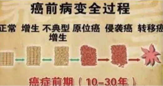 【荐读】肿瘤来之前，都会有“瘤前病变”!很多人没重视(图1)
