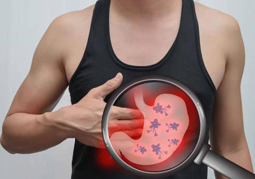 警惕！肚子这样痛，可能是胃癌哟！(图1)