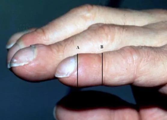 肺癌并非说来就来!出现这些症状,特别是老烟民(图3)