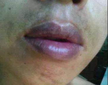 身体的发出5个信号，说明你的血液“粘如浆糊”要当心了！(图4)