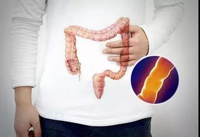 动物脂肪增加大肠癌风险