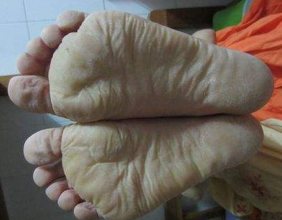 肝不好，脚先知，一旦有这些症状说明肝在求救(图2)