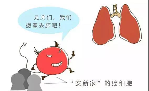 癌细胞发生转移的四个方式!做好以下五点,癌症远离你(图2)