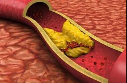 研究血管60年，90岁院士的“养生箴言”，对中老年人太有用(图2)