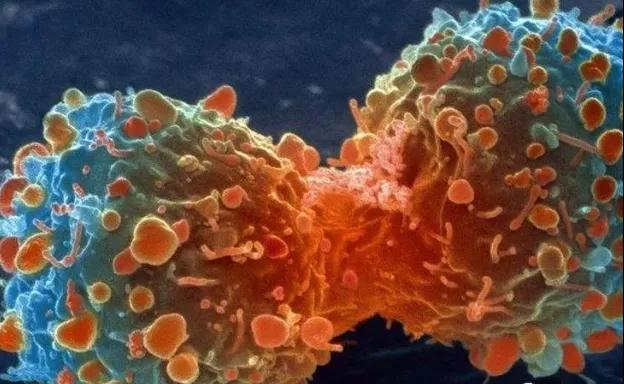 从1个癌细胞，长成肿瘤大概要几年?(图2)