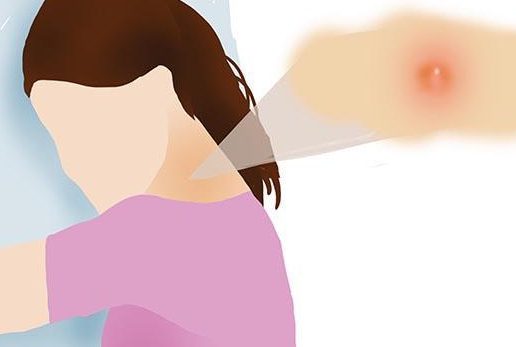 警惕!脖子这4个迹象，暗示癌细胞已“苏醒”(图3)