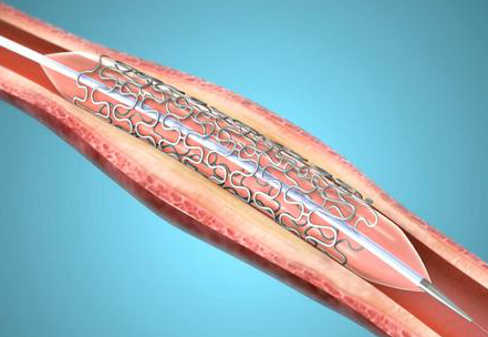 突发!球王马拉多纳心梗去世，瑶医专家：清理血管毒素..(图7)