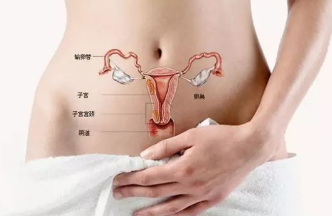 让20% 的女性中招的子宫肌瘤，是什么原因?会癌变吗?(图2)
