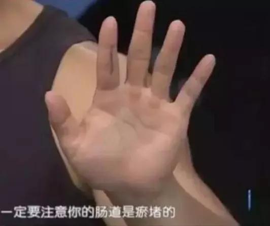 “青筋爆，大病到”这些部位出现青筋，千万不要忽视!(图2)