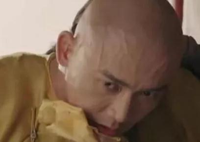 “青筋爆，大病到”这些部位出现青筋，千万不要忽视!(图3)