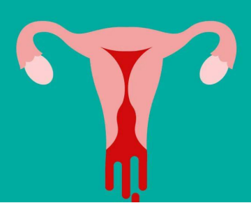 女性肥胖?姨妈乱来?当心这个女性常见恶性肿瘤(图2)