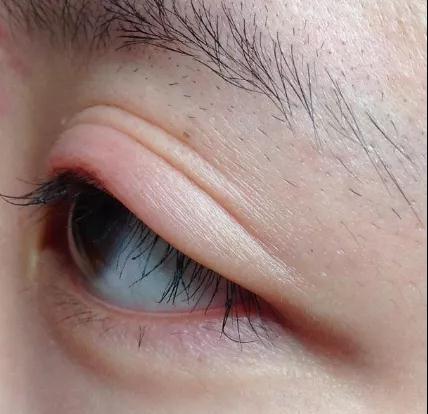 “喝水都胖”?究竟是身体哪里出了问题?(图2)