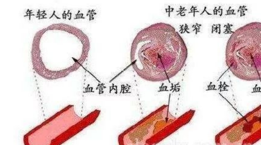 虚→寒→湿→凝→瘀→堵→瘤→癌!测测你的身体走到哪一步(图4)