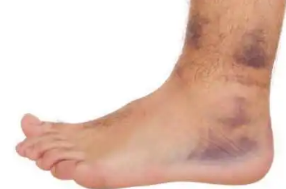 40岁后身体出现这七个信号，说明体内已有癌细胞，别再忽视(图3)