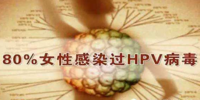 80%的女性在50岁前会感染HPV，关于 HPV 的 误区(图2)