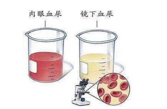 警惕!身体这7处“异常”出血，可能是“癌症” 来袭!(图4)