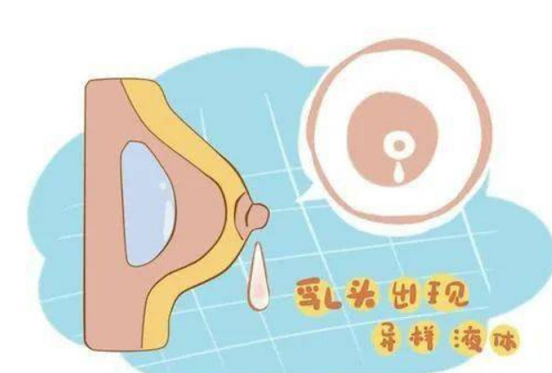 警惕!身体这7处“异常”出血，可能是“癌症” 来袭!(图5)