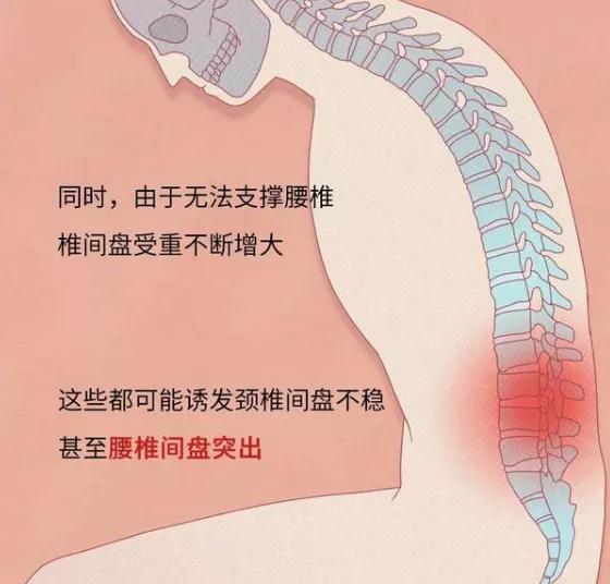 上厕所玩手机可能让你“从头伤到脚”!看完你还敢玩吗 ?(图2)