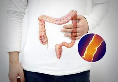 动物脂肪的种种致癌危害，向肉食说NO!(图3)