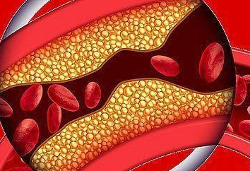 “斑块”和“血栓”，到底啥关系? 分清楚太重要了!(图2)