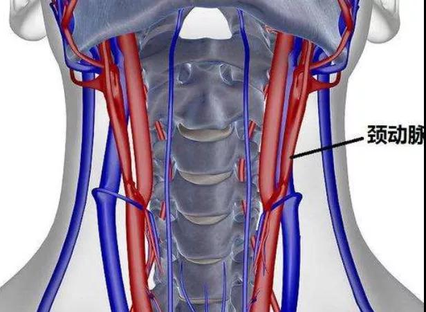 为什么颈动脉最容易堵? 如何发现颈动脉异常?(图2)